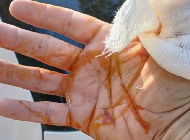 Obe šake su mi isečene, krvi je bilo svuda: Incident na planini Kablar, došlo do sukoba ekoloških aktivista i radnika obezbeđenja oko postavljene barikade