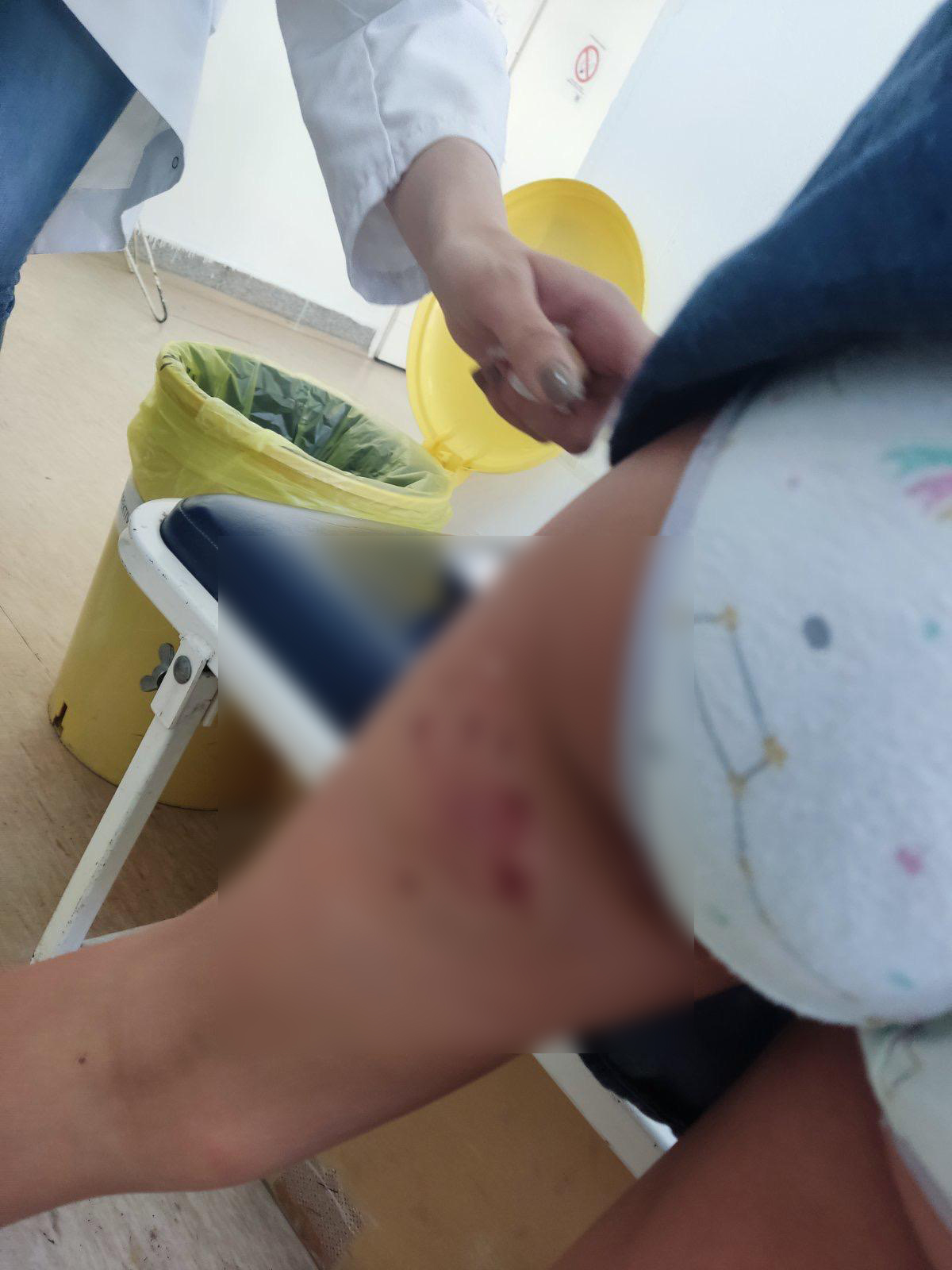 Pas lutalica napao sedmogodišnju devojčicu dok se igrala u svom dvorištu/ Foto: Privatna arhiva