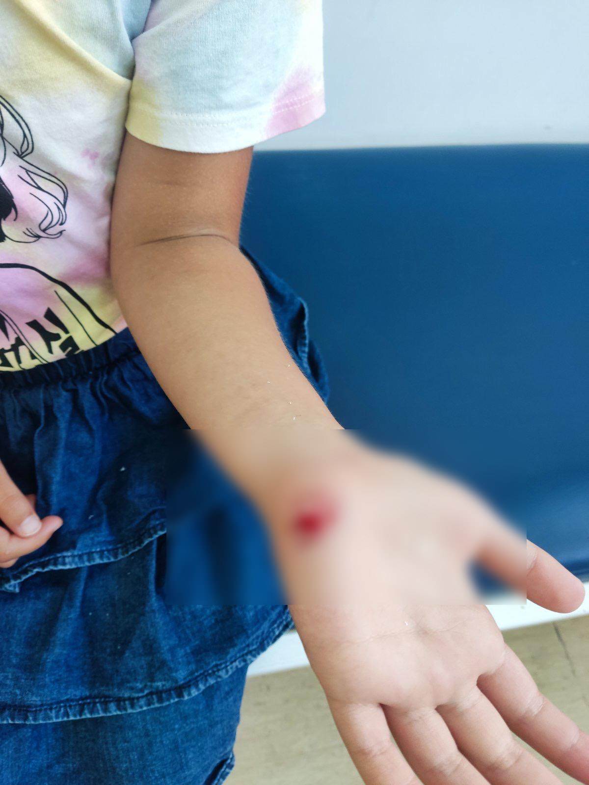 Pas lutalica napao sedmogodišnju devojčicu dok se igrala u svom dvorištu/ Foto: Privatna arhiva