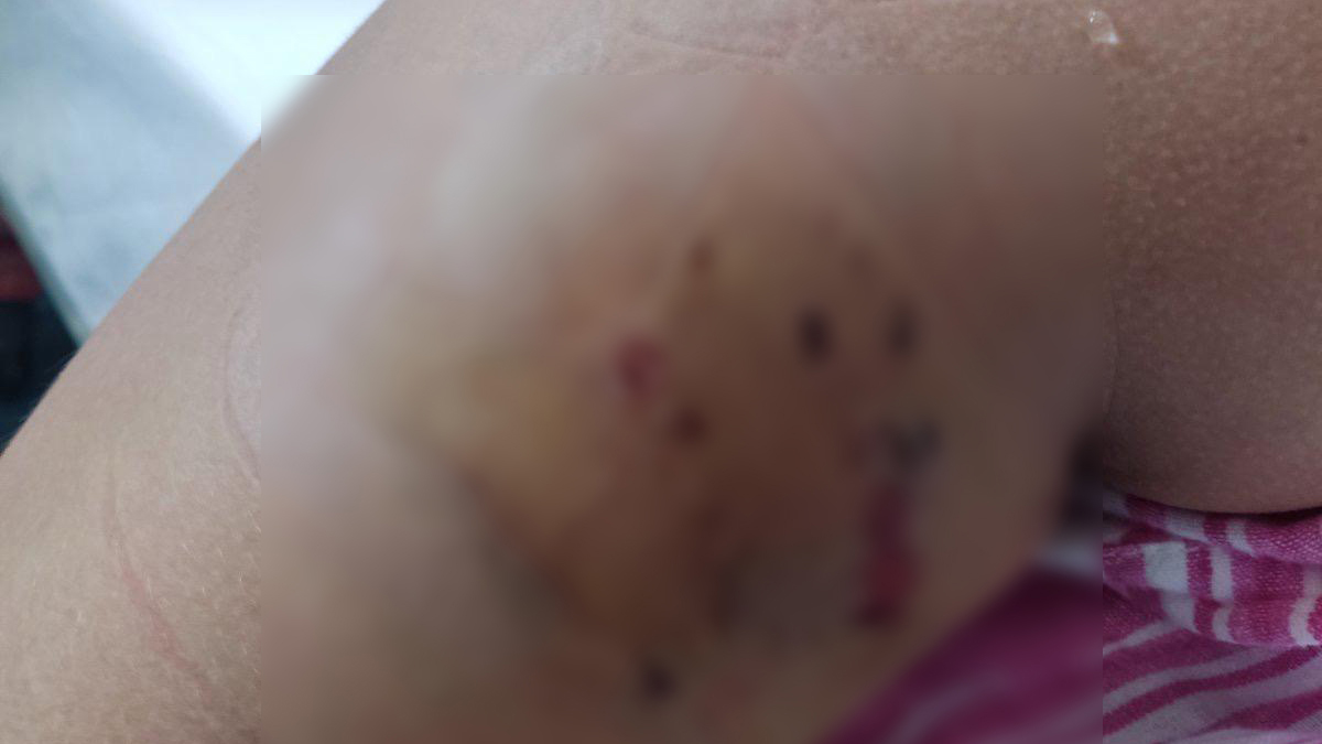 Pas lutalica napao sedmogodišnju devojčicu dok se igrala u svom dvorištu/ Foto: Privatna arhiva