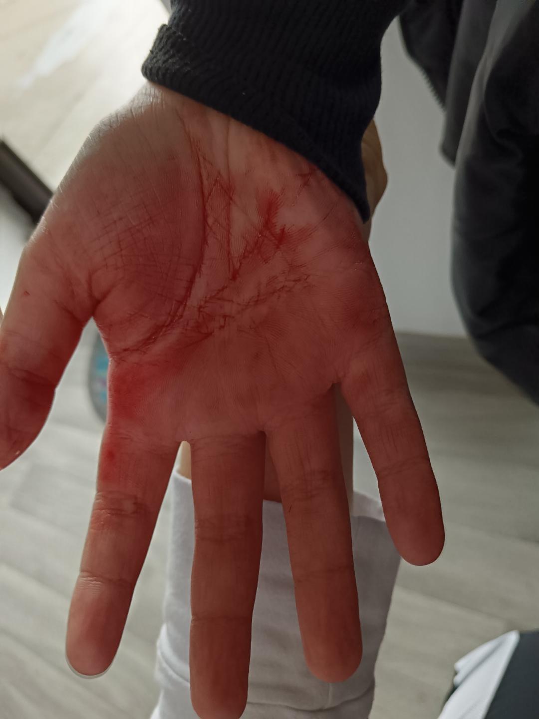 Dečaka iz Vlasotinca maltretirali dečaci iz razreda / foto: Privatna arhiva